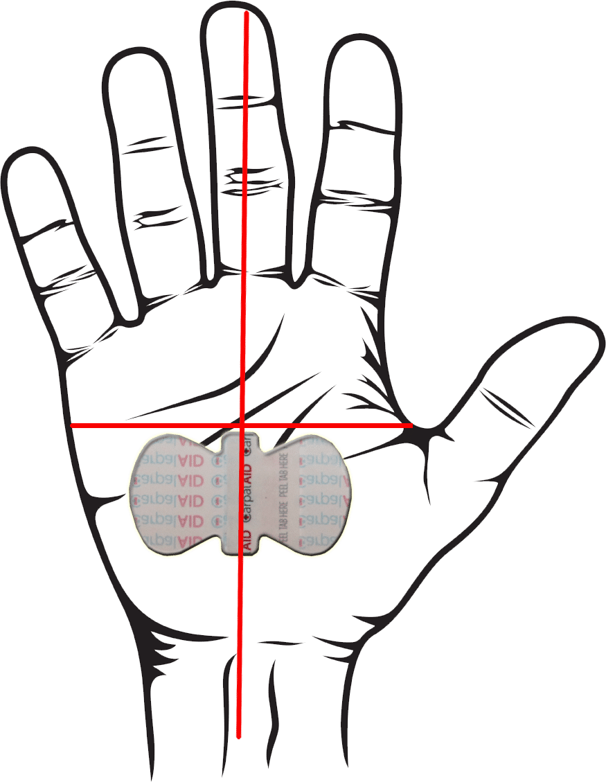 CarpalAID-Hand-Position-Final