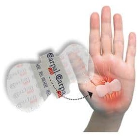 CarpalAid