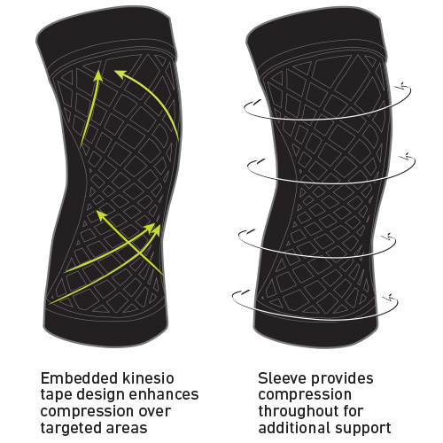 Spark_Knee_PRODdetail