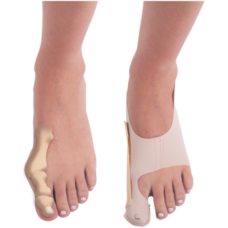PediFix BunionBoss™ Adjustable Bunion Support Splint